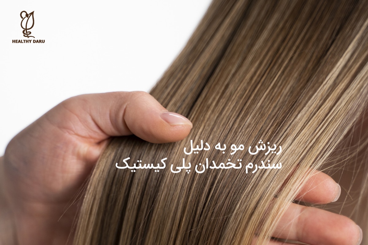 آیا سندرم تخمدان پلی کیستیک باعث ریزش مو میشود؟