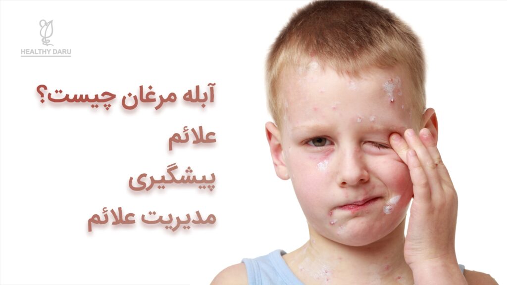 آبله مرغان چیست؟ هلثی دارو