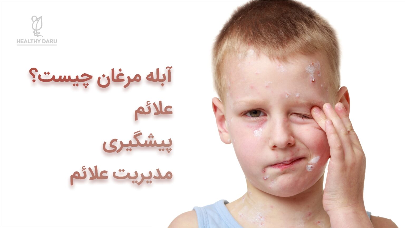 آبله مرغان چیست؟ هلثی دارو