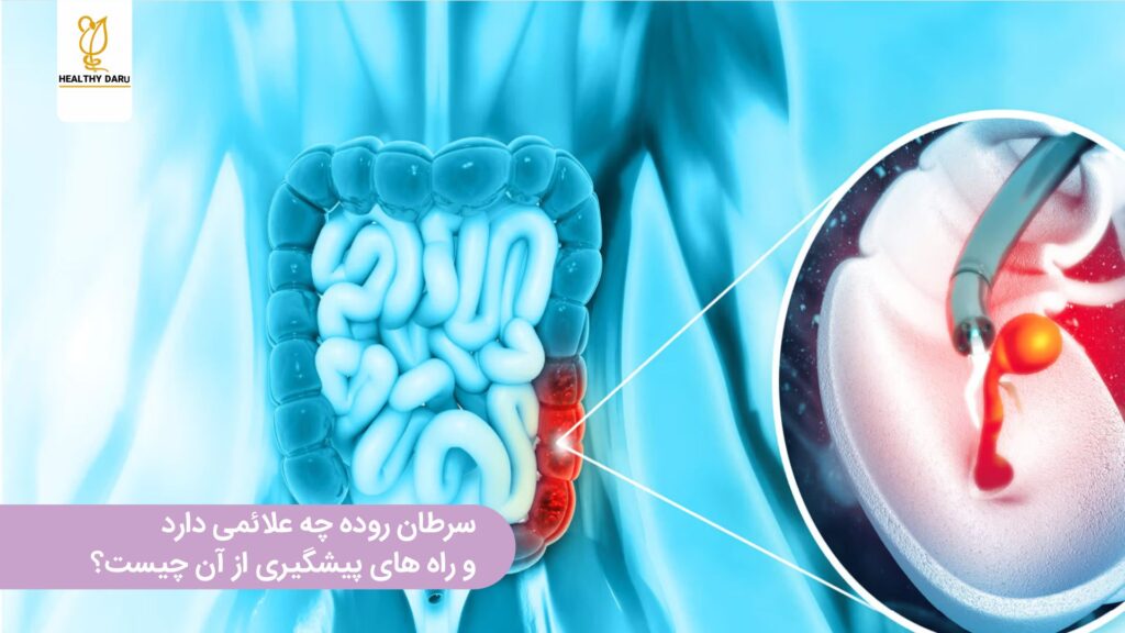 سرطان روده چیست و چه علائمی دارد؟ داروخانه آنلاین هلثی دارو