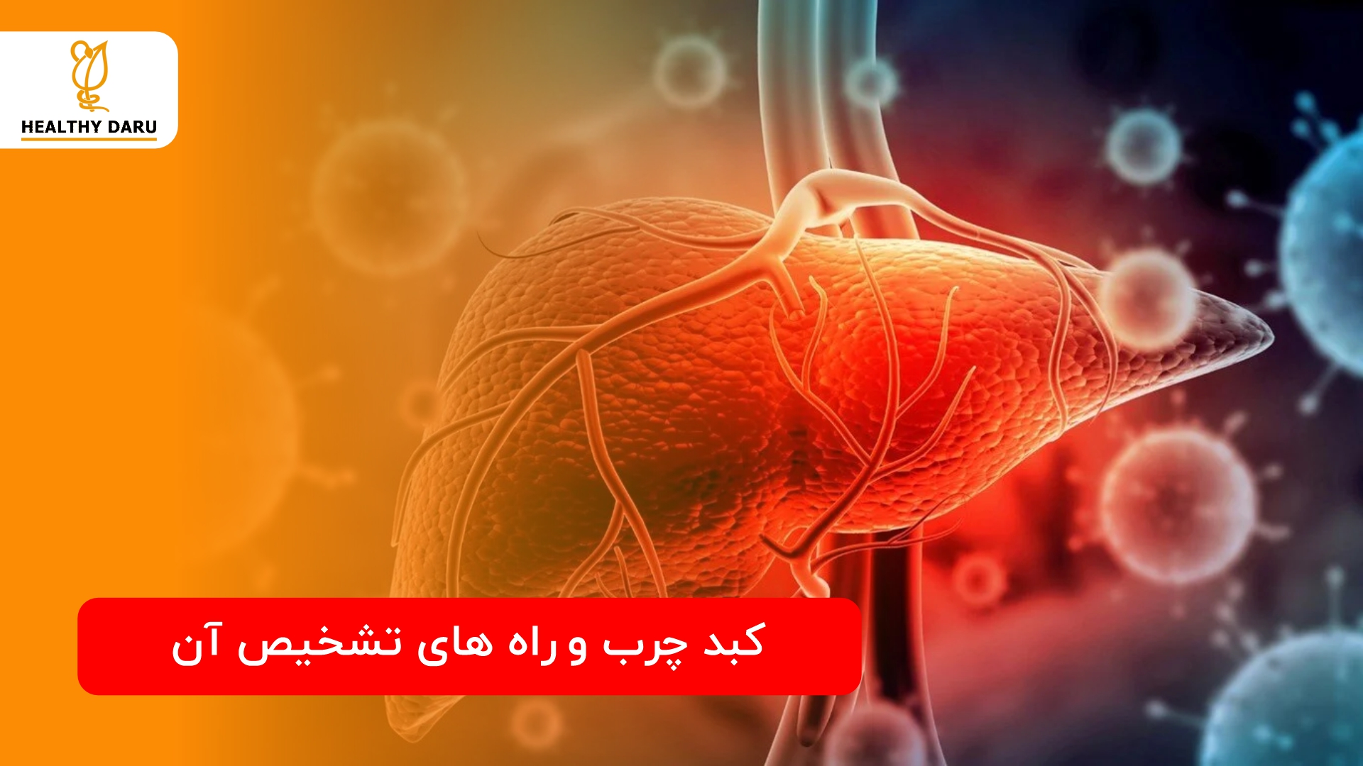 راه تشخیص کبد چرب چیست؟