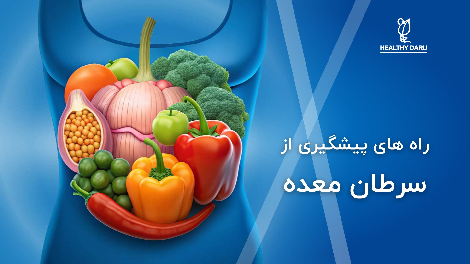 چه راه هایی برای پیشگیری از سرطان معده وجود دارد؟