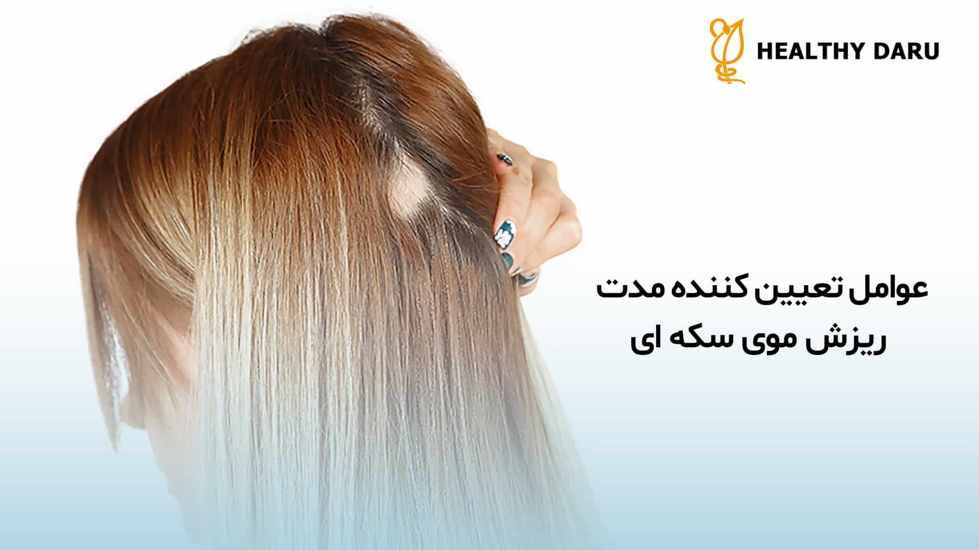 ریزش موی سکه ای چه مدت ادامه می یابد؟