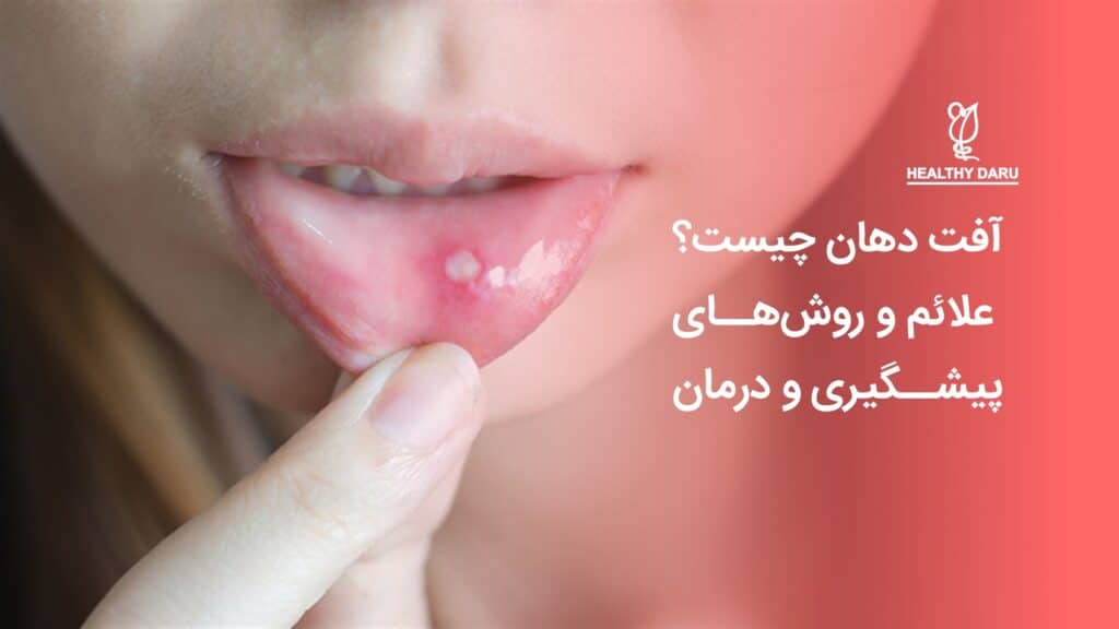 آفت دهان چیست؟ علائم و روش‌های پیشگیری و درمان - داروخانه آنلاین هلثی دارو